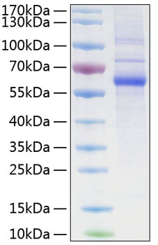Recombinant Human LAG-3/CD223 Protein was determined by SDS-PAGE under reducing conditions with Coomassie Blue.
