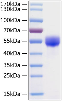 Recombinant Human Fetuin A/AHSG Protein was determined by SDS-PAGE under reducing conditions with Coomassie Blue.