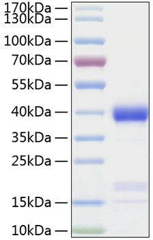 Recombinant Human Azurocidin/CAP37/AZU1 Protein was determined by SDS-PAGE under reducing conditions with Coomassie Blue.
