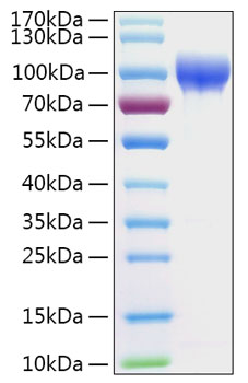 Recombinant Human Serpin G1/Plasma protease C1 inhibitor Protein was determined by SDS-PAGE under reducing conditions with Coomassie Blue.