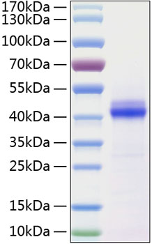 Recombinant Human CD5L Protein was determined by SDS-PAGE under reducing conditions with Coomassie Blue.