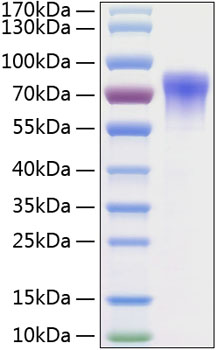Recombinant Human GDNFR-alpha-2/GFRA2 Protein was determined by SDS-PAGE under reducing conditions with Coomassie Blue.