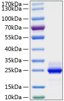 Recombinant Human IL-6 Protein was determined by SDS-PAGE under reducing conditions with Coomassie Blue.