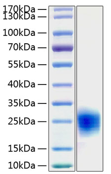 Recombinant Human Cripto-1/TDGF1 Protein was determined by SDS-PAGE under reducing conditions with Coomassie Blue.