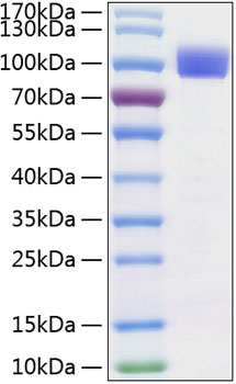 Recombinant Human TYRO3 Protein was determined by SDS-PAGE under reducing conditions with Coomassie Blue.