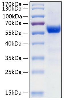 Recombinant Human Frizzled-7/FZD7 Protein was determined by SDS-PAGE under reducing conditions with Coomassie Blue.