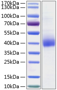 Recombinant Human CD301 Protein was determined by SDS-PAGE under reducing conditions with Coomassie Blue.