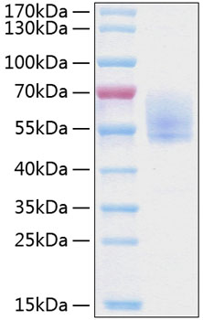 Recombinant Human Podoplanin/PDPN Protein was determined by SDS-PAGE under reducing conditions with Coomassie Blue.