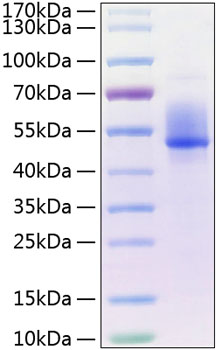Recombinant Human Dkk-3 Protein was determined by SDS-PAGE under reducing conditions with Coomassie Blue.