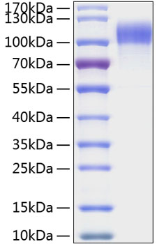 Recombinant Human HER1/ERBB1/EGFR Protein was determined by SDS-PAGE under reducing conditions with Coomassie Blue.