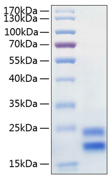 Recombinant Human IL-17A/CTLA-8 Protein was determined by SDS-PAGE under reducing conditions with Coomassie Blue.