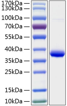 Recombinant Human IGFBP-2 Protein was determined by SDS-PAGE under reducing conditions with Coomassie Blue.