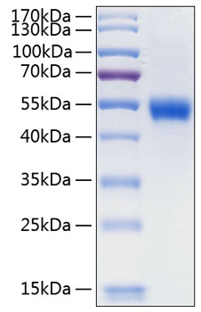 Recombinant Human Lumican/LUM Protein was determined by SDS-PAGE under reducing conditions with Coomassie Blue.
