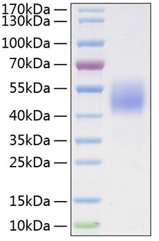 Recombinant Human B7-H4/VTCN1 Protein was determined by SDS-PAGE under reducing conditions with Coomassie Blue.
