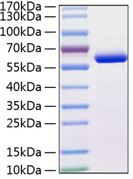 Recombinant Human MMP-13 Protein was determined by SDS-PAGE under reducing conditions with Coomassie Blue.