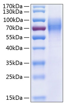 Recombinant Human Trk-C/NTRK3 Protein was determined by SDS-PAGE under reducing conditions with Coomassie Blue.