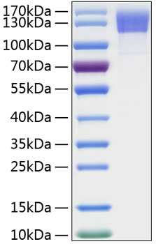 Recombinant Human OSMR/IL-31RB Protein was determined by SDS-PAGE under reducing conditions with Coomassie Blue.