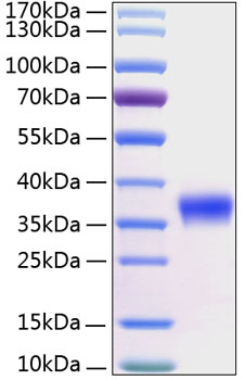 Recombinant Human Kallikrein-8/KLK8 Protein was determined by SDS-PAGE under reducing conditions with Coomassie Blue.