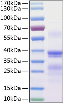 Recombinant Human RGMA Protein was determined by SDS-PAGE under reducing conditions with Coomassie Blue.