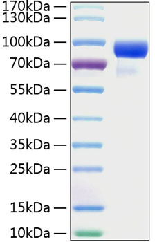 Recombinant Human Hedgehog-interacting protein/HHIP Protein was determined by SDS-PAGE under reducing conditions with Coomassie Blue.