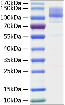 Recombinant Human ITGB1/CD29 Protein was determined by SDS-PAGE under reducing conditions with Coomassie Blue.