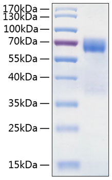 Recombinant Human TIM-3/HAVCR2/CD366 Protein was determined by SDS-PAGE under reducing conditions with Coomassie Blue.