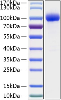 Recombinant Human IL-1R2/CD121b Protein was determined by SDS-PAGE under reducing conditions with Coomassie Blue.