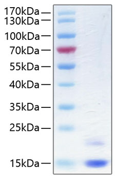 Recombinant Human Cystatin-M/CST6 Protein was determined by SDS-PAGE under reducing conditions with Coomassie Blue.