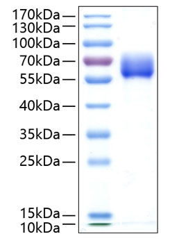 Recombinant Human TGF-beta receptor type-2/TGFR-2 Protein was determined by SDS-PAGE under reducing conditions with Coomassie Blue.
