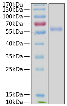 Recombinant Human NKG2D ligand 3/ULBP3 Protein was determined by SDS-PAGE under reducing conditions with Coomassie Blue.