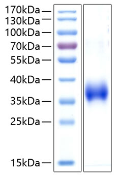 Recombinant Human CD2 Protein was determined by SDS-PAGE under reducing conditions with Coomassie Blue.