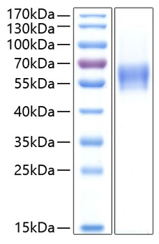 Recombinant Human CNTFR-alpha Protein was determined by SDS-PAGE under reducing conditions with Coomassie Blue.