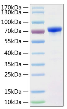 Recombinant Human Alpha-fetoprotein/AFP Protein was determined by SDS-PAGE under reducing conditions with Coomassie Blue.
