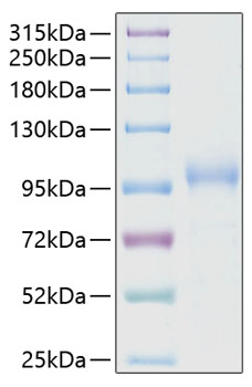 Recombinant Human CDH6/K-Cadherin Protein was determined by SDS-PAGE under reducing conditions with Coomassie Blue.