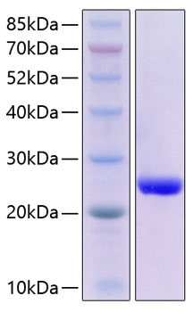 Recombinant Human Serum Amyloid P/SAP Protein was determined by SDS-PAGE under reducing conditions with Coomassie Blue.