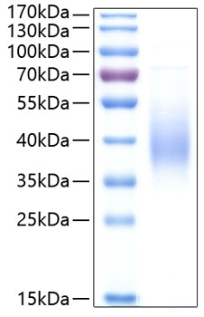Recombinant Human Fc-epsilon RI-alpha/FCER1A Protein was determined by SDS-PAGE under reducing conditions with Coomassie Blue.