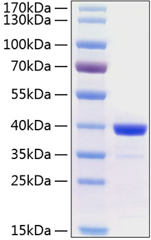 Recombinant Human Arginase 1/ARG1 Protein was determined by SDS-PAGE under reducing conditions with Coomassie Blue.