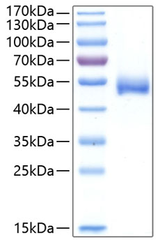 Recombinant Human Chitinase-1/CHIT1 Protein was determined by SDS-PAGE under reducing conditions with Coomassie Blue.