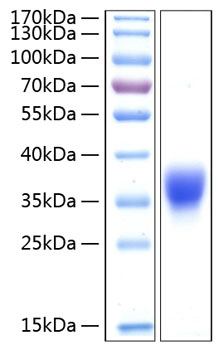 Recombinant Human BTN1A1/Butyrophilin Protein was determined by SDS-PAGE under reducing conditions with Coomassie Blue.