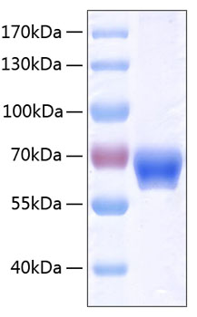 Recombinant Human Ephrin-B1/EFNB1 Protein was determined by SDS-PAGE under reducing conditions with Coomassie Blue.