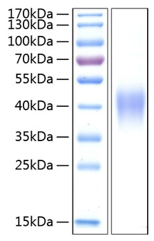 Recombinant Human TNFRSF1B/TNF-R2/CD120b Protein was determined by SDS-PAGE under reducing conditions with Coomassie Blue.