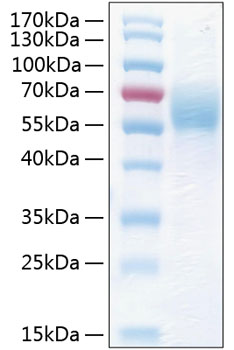 Recombinant Human THSD1 Protein was determined by SDS-PAGE under reducing conditions with Coomassie Blue.