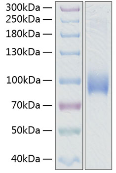 Recombinant Human L-Selectin/SELL/CD62L Protein was determined by SDS-PAGE under reducing conditions with Coomassie Blue.