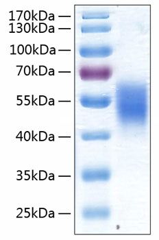 Recombinant Human ALK-7/ACVR1C Protein was determined by SDS-PAGE under reducing conditions with Coomassie Blue.