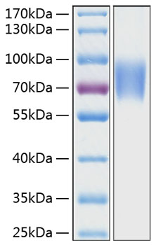 Recombinant Human LFA-3/CD58 Protein was determined by SDS-PAGE under reducing conditions with Coomassie Blue.