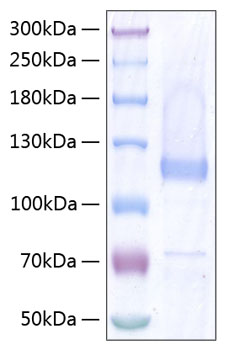 Recombinant Human Thrombospondin-5/COMP Protein was determined by SDS-PAGE under reducing conditions with Coomassie Blue.