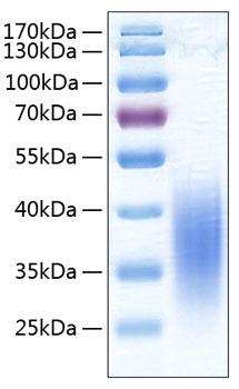 Recombinant Human B7-H5/Gi24/VISTA Protein was determined by SDS-PAGE under reducing conditions with Coomassie Blue.