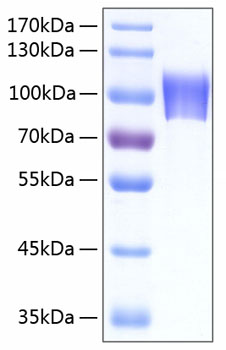 Recombinant Human Neuroligin-4/NLGN4X Protein was determined by SDS-PAGE under reducing conditions with Coomassie Blue.