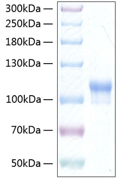 Recombinant Human Neuroligin-3/NLGN3 Protein was determined by SDS-PAGE under reducing conditions with Coomassie Blue.