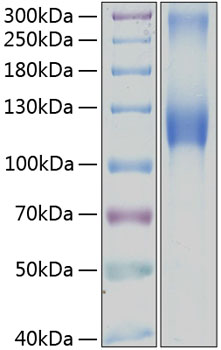Recombinant Human Osteoactivin/GPNMB Protein was determined by SDS-PAGE under reducing conditions with Coomassie Blue.
